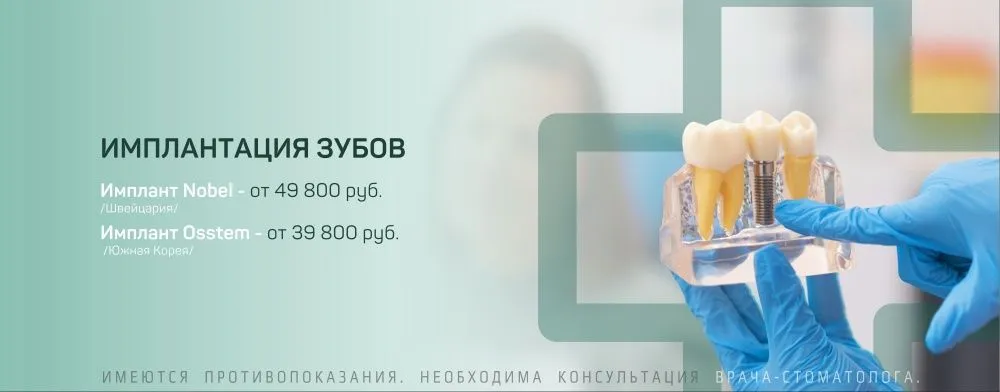 Импланты