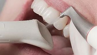 Air Flow