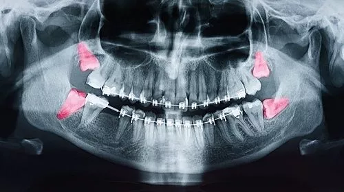 Прием стоматолога-хирурга