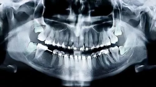 Прием стоматолога-хирурга